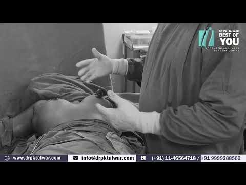 Transaxillary Breast Augmentation | Underarm Se Implant Surgery | Procedure By Dr. P.K. Talwar