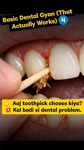 Toothpick Band Karo! Yeh 3 Safe Interdental Cleaning Methods Use Karo #Nagpur #dentalcare #dentist