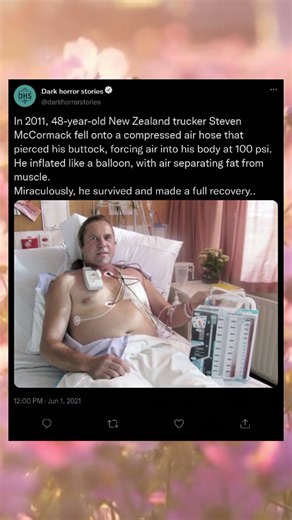 The Man Who Inflated Like a Balloon and Lived #viral