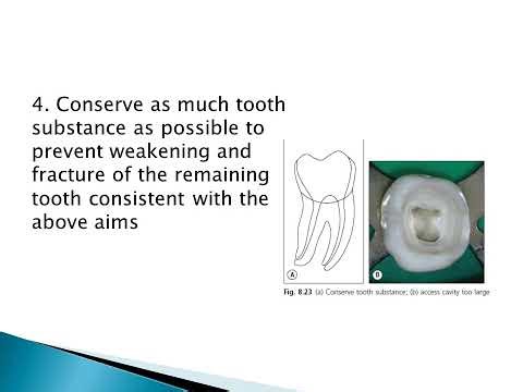 CORONAL ACCESS CAVITIES PPT | FPD | Lecture | PPTX
