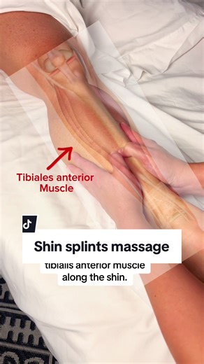 Effective Shin Splints Massage Techniques for Relief