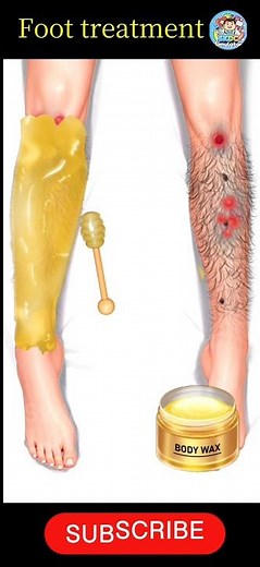 Foot Doctor Treatment Game | Pairon ka Full Treatment"🦵👈💯#treatment #3dgames #gameplay