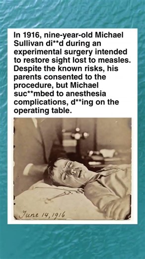 The Tragic 1916 Surgery of Michael Sullivan #shorts #facts #history #historyfacts #survival