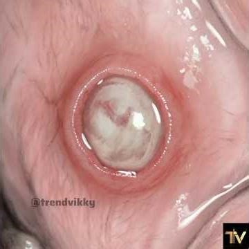 Before You Chew Again — Watch This 😥