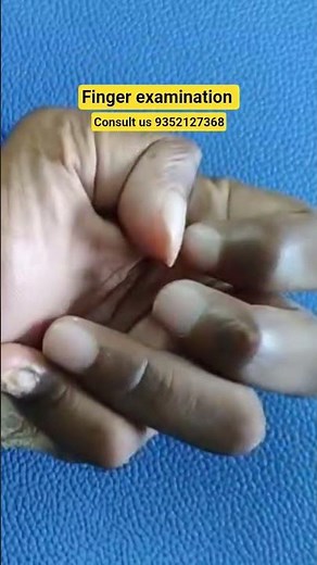 finger examination #physiotherapy #stiffness #ruhs #splint #plaster #finger #thumb #wrist #nims