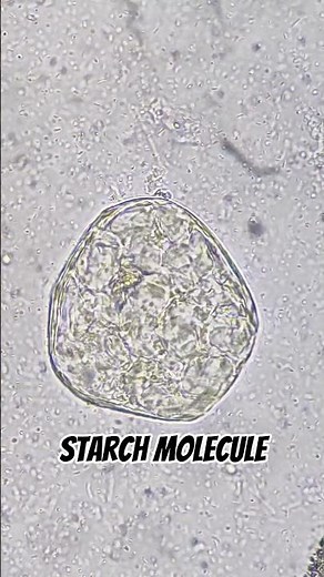 Stool under Microscope 🔬 | Helminths egg | Vegetable fiber | Undigested food particles