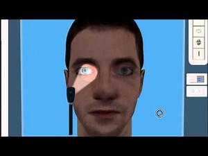 2.1 RAPD and pupil exam F400602B B4D8 4286 AB3F 4253FCD4E8AB