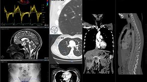 DMS Imaging devient European Medical Solutions