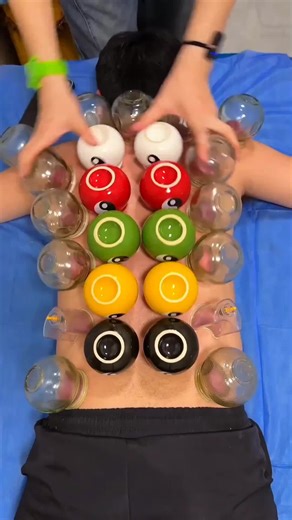 Discover the Soothing Sounds of Cupping Therapy