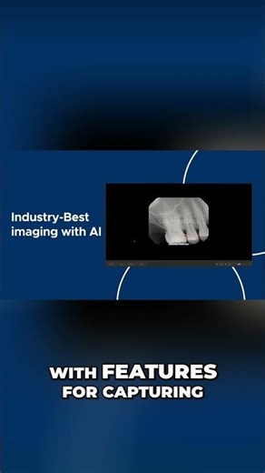 Dentrix Ascend: AI Dental Imaging, Built Into Your Workflow