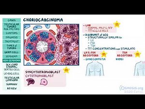 Testicular Tumors | Osmosis