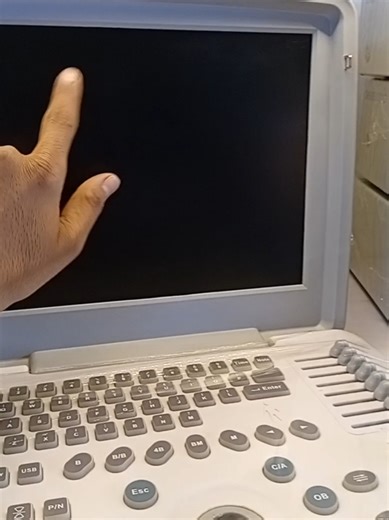 Slightly Used Apollo 7 Ultrasound Machine for Sale
