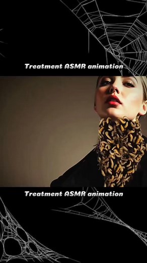 Treatment necks ASMR Part 1 asmr asmrsounds foryoupag | Treatment Animated