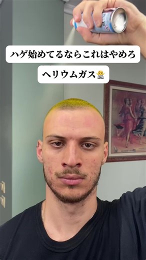 禿げを止めるためにすること３選！！ これでもう恥ずかしい思いはゼロ 新時代の解決策 🛍️今なら全国送料無料＋59%SALE開催中！ ☺️コスパ最強をプロフからゲット #fyp #おすすめ #おすすめ乗りたい