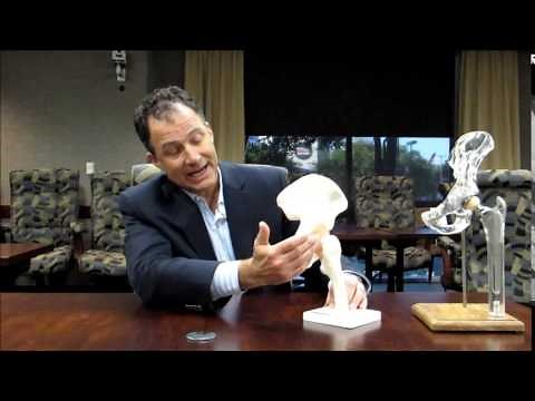 Surgical Approaches to Hip Replacement - Dr. Sergio Viroslav