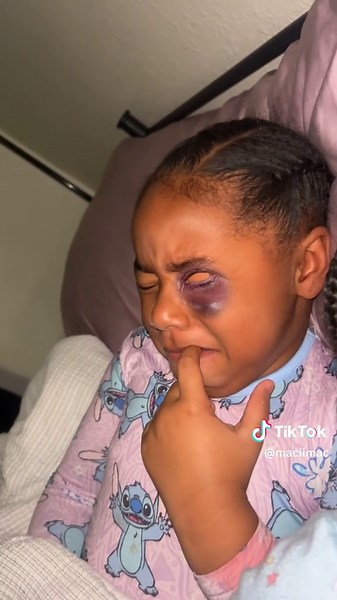 Since she didn’t wake up with her black eye still there I had to use a filter 😂😂😂😂 #elfontheshelf