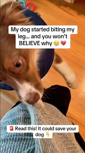 My dog started biting my leg…. and you won’t believe WHY 😱