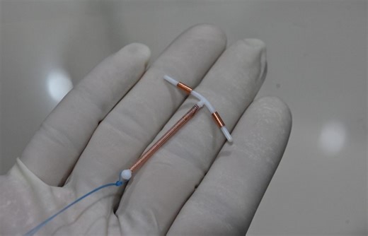 Why IUD insertions are painful for many patients and what can be done better