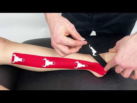 Kinesiology Taping for Medial Ankle Sprain