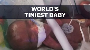 12K views · 156 reactions | She weighed about the same as a big apple...