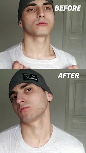 Neck Workout At Home: Best Exercises for a Strong and Healthy Neck