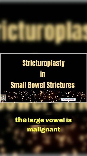 3 Exploring Jabloue Procedure for Scarring 🔍#drstrangemch #surgerycourse #gastricsurgery