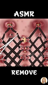 103K views · 772 reactions | ASMR Corset Piercing Worm & Maggot Removal Severely Injured Animatio | Nikolas Bushi | Facebook