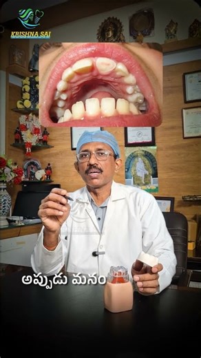 How to Treat a Broken Tooth | Krishna Sai Dental Care #krishnasaidentalcare