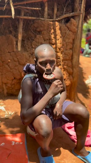 The lip plate is a traditional ornament worn by some women from ethnic groups in the Omo Valley of Ethiopia, such as the Mursi and the Surma (Suri). It consists of a clay or wooden disc inserted into the lower lip, which has been previously pierced and stretched over time using pieces of varying sizes.More than just an ornament, the lip plate has a deep cultural and symbolic meaning: it represents beauty, maturity, and ethnic pride, and is usually placed when a young woman reaches puberty or is 