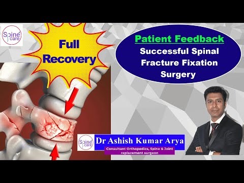 Dr Ashish Kr Arya; Full Recovery; Successful Spinal Fracture Fixation-Patient Feedback; Hindi/Eng.