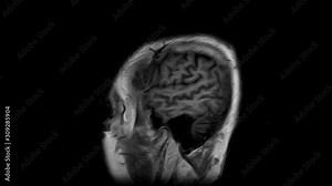 Brain MRI, head scans and tumor detection. Diagnostic medical tool Stock Video