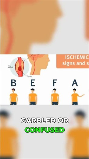 Acting FAST Could Be the Difference Between Life and Death #StrokePrevention #FirstAid