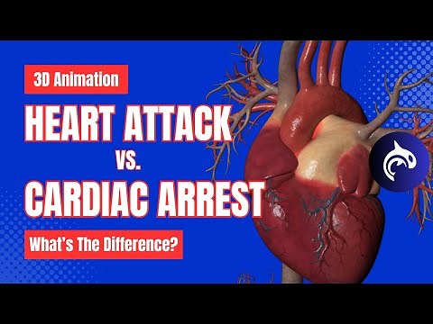 Cardiac Arrest vs Heart Attack - What's the Difference? - 3D Animation