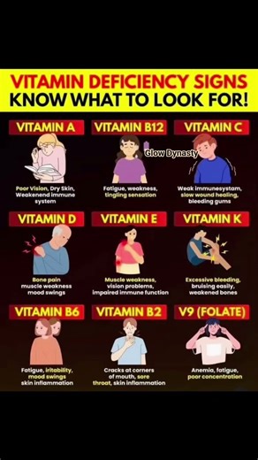 ⚠️ Vitamin Deficiency Signs You Should Never Ignore | Glow Dynasty #shorts #symptoms #nutritiontips
