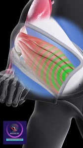 5K views · 39 reactions | Medical Animation Media on Reels | Facebook