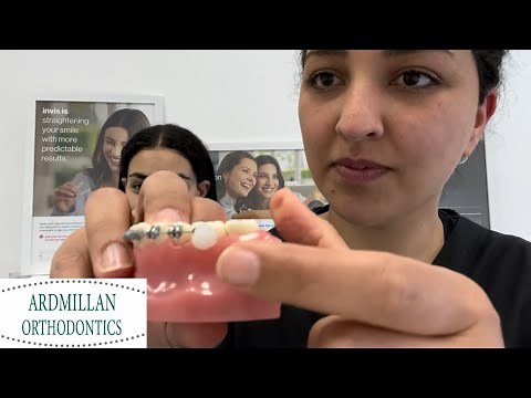 How to Apply Soft Wax to your Braces when in Pain