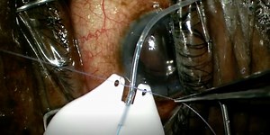 Salvaged Cut Tube - Eyetube