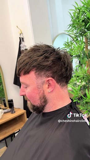 Transform Your Look with Innovative Male Hair Systems