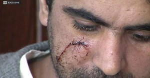 Exclusive: Manhattan gas station worker says he was slashed in face