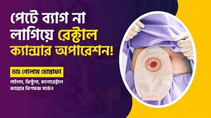 ✅Rectal Cancer Treatment: Alternatives to Colostomy Bags |ব্যাগ না লাগিয়ে রেক্টাল ক্যান্সার অপারেশন! - 🩺ডাঃ গোলাম মোস্তাফা পাইলস, ফিস্টুলা, কলোরেক্টাল ক্যান্সার এবং পেলভিক ফ্লোর ডিজঅর্ডার বিশেষজ্ঞ সার্জন এমবিবিএস, এমআরসিএস (ইউ কে), এফসিপিএস (সার্জারি), এমএস (কলোরেক্টাল সার্জারি) লেজার ও ল্যাপারোস্কোপিক সার্জারি সহকারী অধ্যাপক, (কলোরেক্টাল সার্জারি) ঢাকা মেডিকেল কলেজ। ... ✅চেম্বার: 🏥এ এম জেড হসপিটাল লিমিটেড ৮০/৩, প্রগতি সরণি, উত্তর বাড্ডা, ঢাকা ⏱শনি, রবি সোম ও বুধবার (৬ টা থেকে ৯ টা) 📞সিরিয়াল