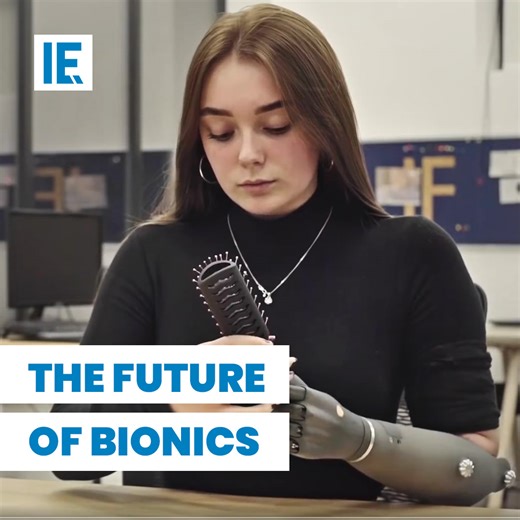 273K views · 3.1K reactions | This smart bionic hand learns and gets better the more you use it. | Interesting Engineering | Facebook