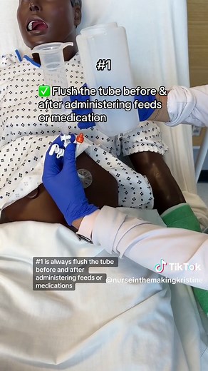 Understanding PEG Tubes: Tips for Nursing Students