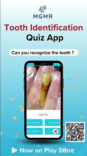 Test Your Knowledge | Tooth Identification Quiz