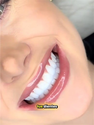 💊 Nobs Tabletas de Pasta Dental - Sensación de Limpieza Total 💊 Limpia, protege y refresca tu boca sin químicos agresivos 🌿🦷 ¡La opción favorita para un cuidado bucal saludable! **Envío GRATIS** a todo el Perú 🇵🇪 #pastadental #nobs #dientesblancos #nanohidroxiapatita #caries #dientesamarillos #lima