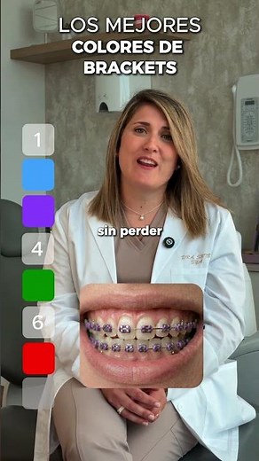 Ranking de los mejores colores para brackets 🦷✨