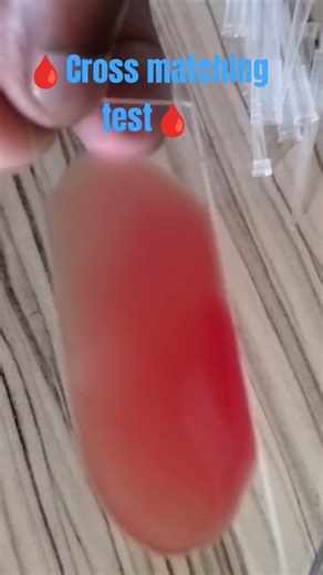 🩸 Cross matching test 🩸#shorts #youtube