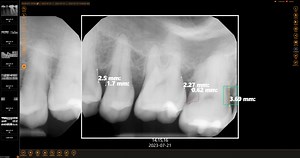 Dental Imaging AI Now Available From Planet DDS