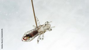 Head louse on a the top of human hair. Extreme closeup detail of human parasite. Pediculus capitis. Human infectious disease. Stock Video