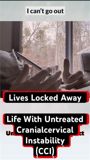 Lives Locked Away: Living With Untreated Cranialcervical Instability (CCI) #cci