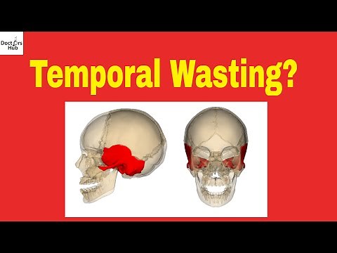 Cancer Wasting || Temporal Wasting || Wasting Syndrome || Malignant Cachexia
